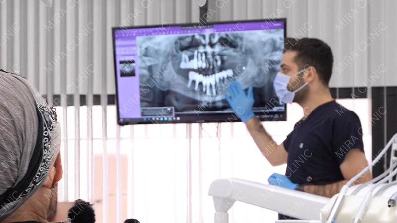 celebrity experience cheb bilal